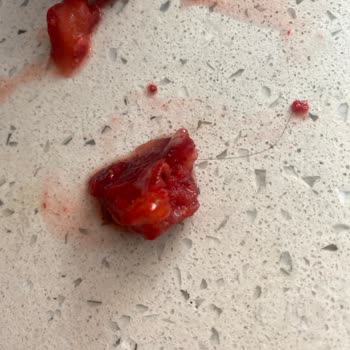 IFF's Hijyen Sorunu: Dondurulmuş Çilek Paketinde Saç Kılı!