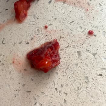 IFF's Hijyen Sorunu: Dondurulmuş Çilek Paketinde Saç Kılı!