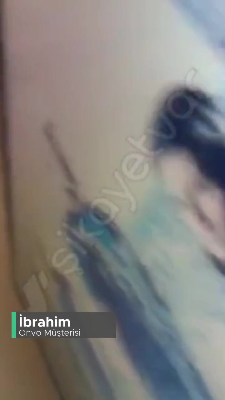 Onvo Pişmanlık Ötesi Ve Müşteriye Değer Yok... videonun kapak resmi