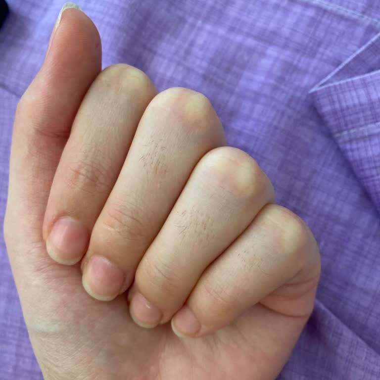 Aris Güzellik Merkezleri Balıkesir'deki Lazer Epilasyon Merkezinde Beklenen Sonuçları Alamadım