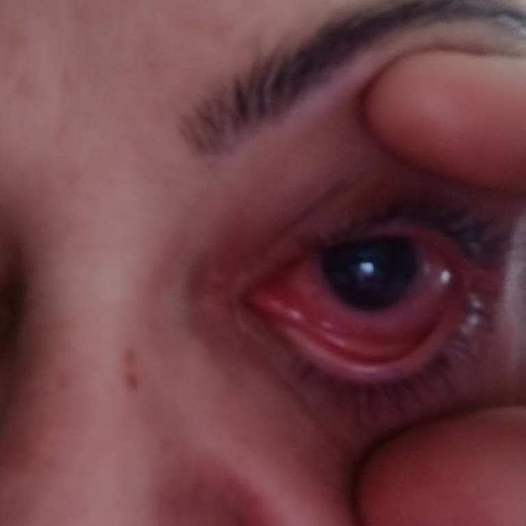 Özel Ekol Hastanesi (İzmir) Hastane Operasyonu Ve Beklenmedik Sonuçlar