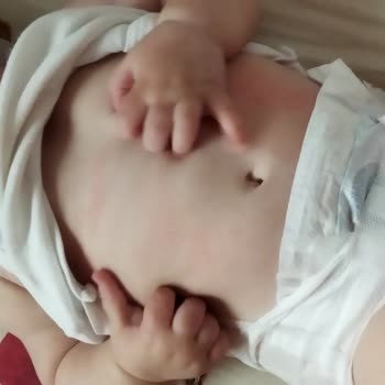 Sma Optipro Alerjisi