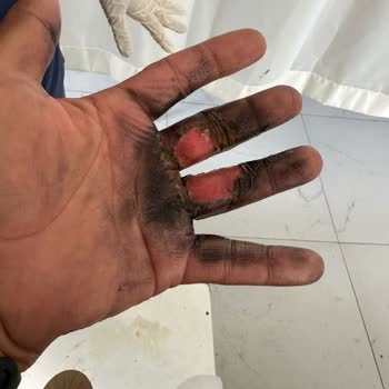 Hazine ve Maliye Bakanlığı Eksik Ve Arızalı Ürün Teslimatı