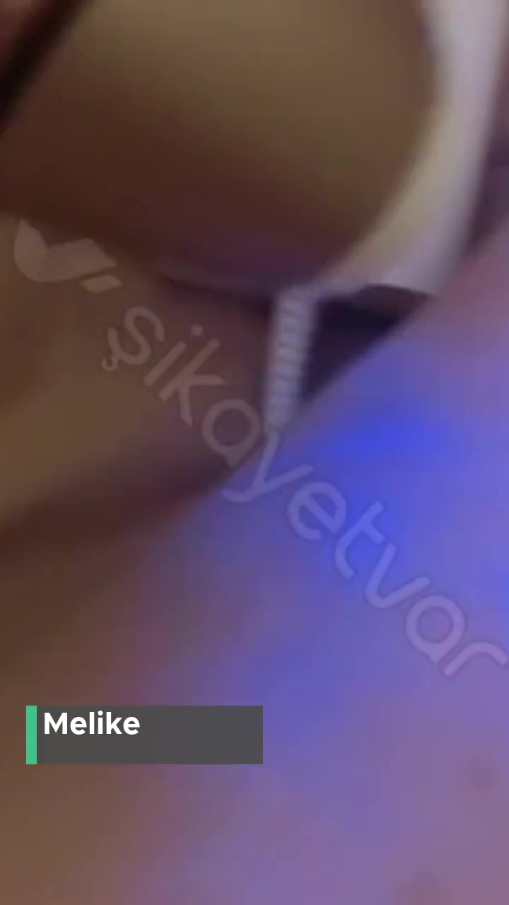 Braun IPL Silk·Expert Pro 5 Kırmızı Işıkta Takılıyor Atış Yapmıyor! videonun kapak resmi