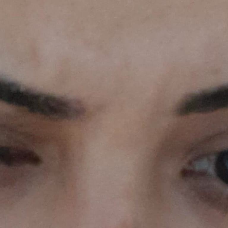 Nivea Şok Market 'ten Alınan Maske Alerji Yaptı