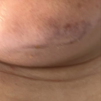 Vi-Vet Tüy Sarartıcı Krem Yüzümü Yaktı