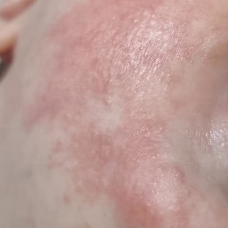 La Roche Posay Lipikar Bebeğimin Cildini Yaktı!