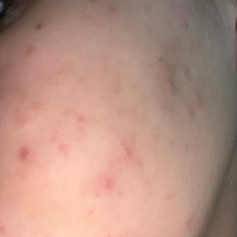 Garnier C Vitamini Serum