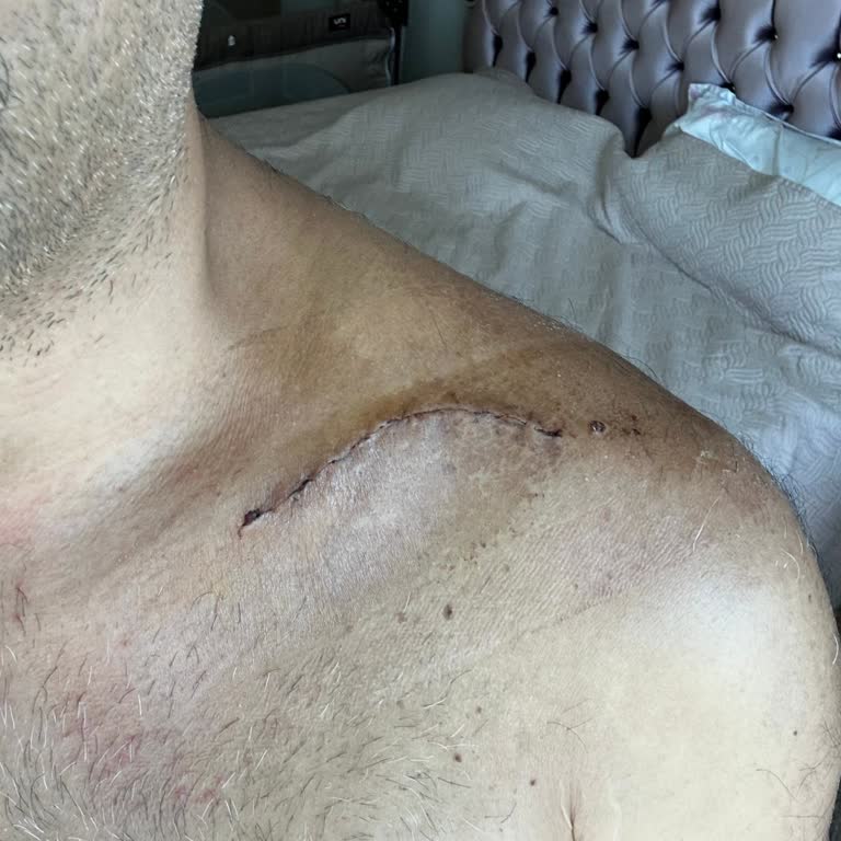 Güral Premier Hotels Belek'te Kaza