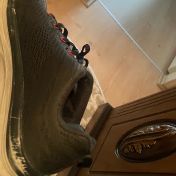 Skechers Ayakkabıda Açılmalar Ve Garanti Kapsamında Sayılmaması