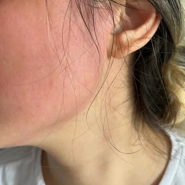 Eyüp Sabri Tuncer Gül Suyu Kullanımı Sonrası Ciltte Yanma Ve Kızarıklık!