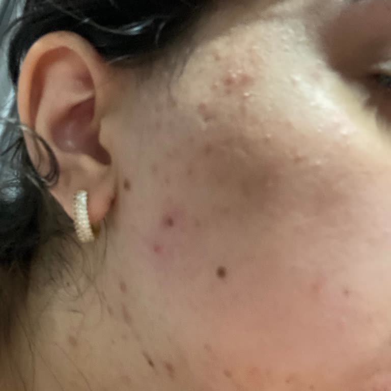 CS Beauty Center Olumsuz Güzellik Salonu Deneyimi