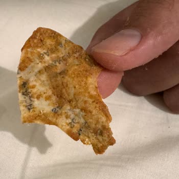 Nut Master N Cipsten Çıkan Yabancı Cisim