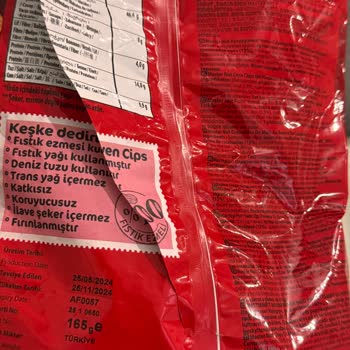 Nut Master N Cipsten Çıkan Yabancı Cisim