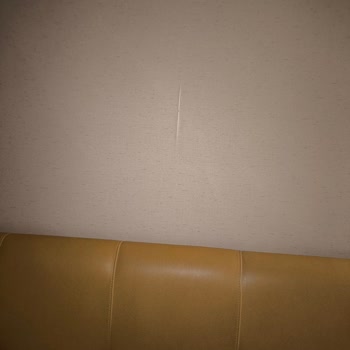 Acapulco Resort Hotel Otel Konaklamasında Yaşanan Sağlık Ve Temizlik Sorunları