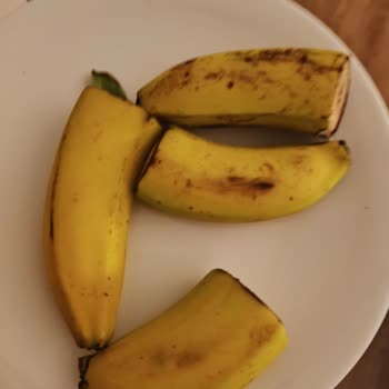 Acapulco Resort Hotel Otel Konaklamasında Yaşanan Sağlık Ve Temizlik Sorunları