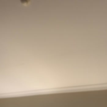 Acapulco Resort Hotel Otel Konaklamasında Yaşanan Sağlık Ve Temizlik Sorunları