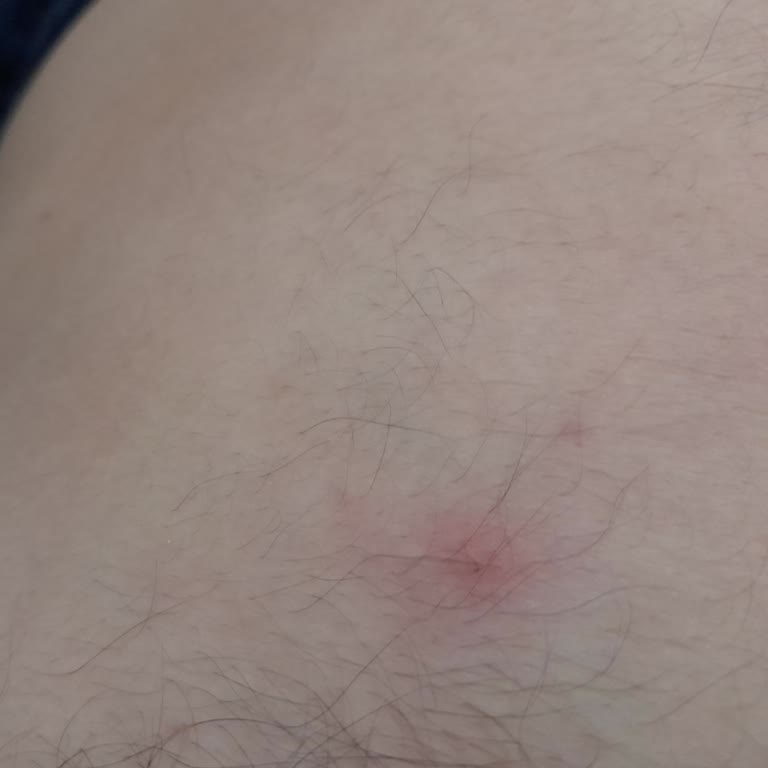 Türkiye İlaç Ve Tıbbi Cihaz Kurumu (titck) Croxilex Antibiyotik Yan Etki Yaptı