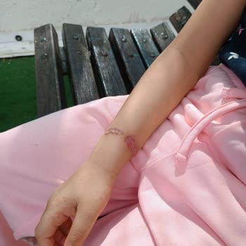 Ercan Bakım Merkezi Bakım Merkezinde Çocuklara Yönelik İddialar