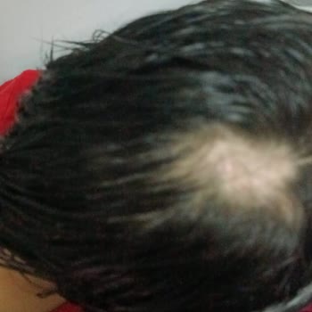 Ercan Bakım Merkezi Bakım Merkezinde Çocuklara Yönelik İddialar