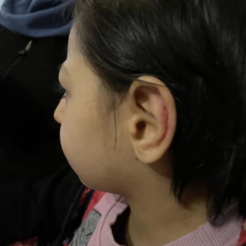 Ercan Bakım Merkezi Bakım Merkezinde Çocuklara Yönelik İddialar