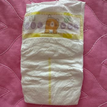 Prima İçerik Değişimi Ve Ciddi Derecede Pişik.