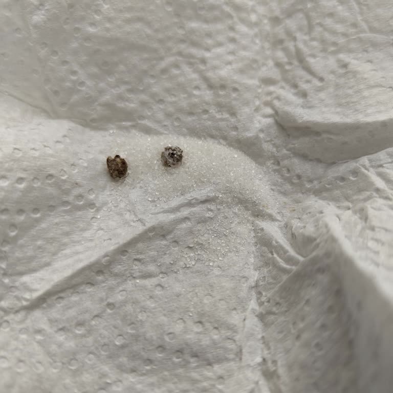 Balküpü Şekerin İçi Yabancı Cisimlerle Dolu