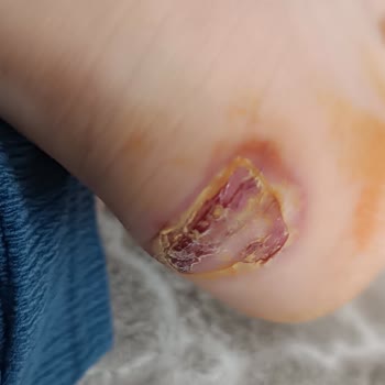 Elle Ayakkabı Elle Mağaza Aldığım Ayakkabı