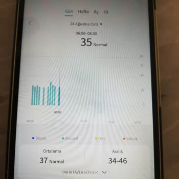 Huawei'nin Müşteri Memnuniyeti İlkesini Hatırlamasını İstiyorum.