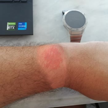 Huawei'nin Müşteri Memnuniyeti İlkesini Hatırlamasını İstiyorum.