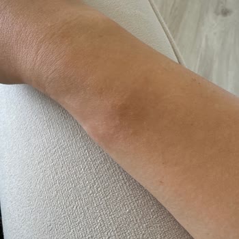 Juju (Jujumood.com) Juju X DeFacto Bileklikleri Alerji Ve Renk Atma Sorunu