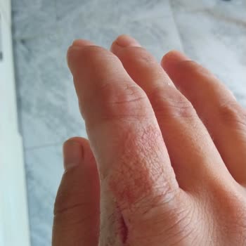 Refikadan Çay Bardağı Güvenlik Sorunu