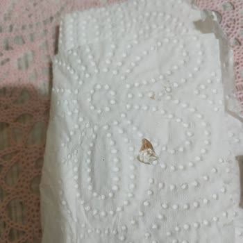 Patiswiss Çikolatasının İçinden Cam Parçası Çıktı.