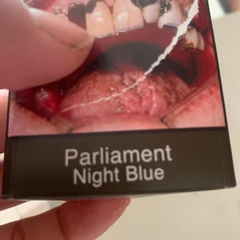 Philip Morris Sigara Filtreden Ayrı