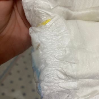 Molfix Bebek Bezinde Kurtlanma Mevcut