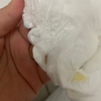 Molfix Bebek Bezinde Kurtlanma Mevcut