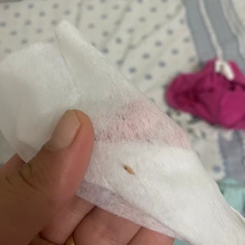 Molfix Bebek Bezinde Kurtlanma Mevcut