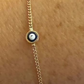 Fiyonk Kuyumculuk Mağduru, Kalitesiz Malzeme