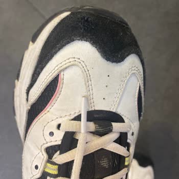 Skechers Ayakkabı Kalitesizliği Ürün 4 Ay Geçmeden Yırtılmaya Başladı