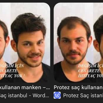 Hairlife International Kişisel Fotoğraflarım İzinsiz Kullanılıyor