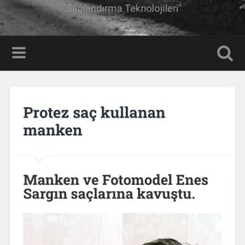 Hairlife International Kişisel Fotoğraflarım İzinsiz Kullanılıyor