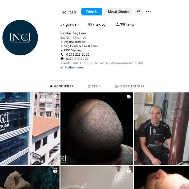 İnci Saç Ekim Merkezi / Afyonkarahisar Aradığımda Daha Bir Şey Demeden Saygısızlık Yaptı!