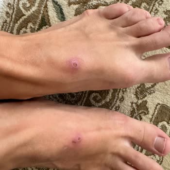 Nomadic Republic Hasır Sandaletin Rahatsız Edici Deneyimi