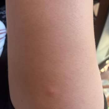 Detan Sinek Tableti: Beklentileri Karşılamayan Ürün