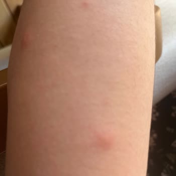 Detan Sinek Tableti: Beklentileri Karşılamayan Ürün