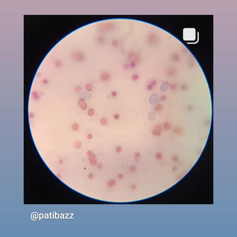 Bodrum Hayvan Hastanesi İhmalkarlığı Ve Maddi, Manevi Zarara Uğratması