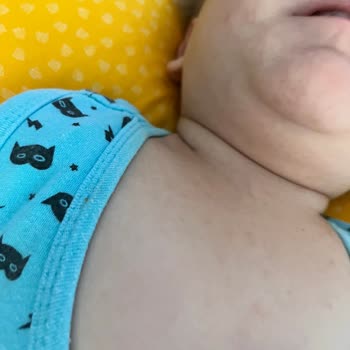 Nurse Harvey’s Nurse Harvey's Diş Jeli Bebeğe Alerji Yaptı!