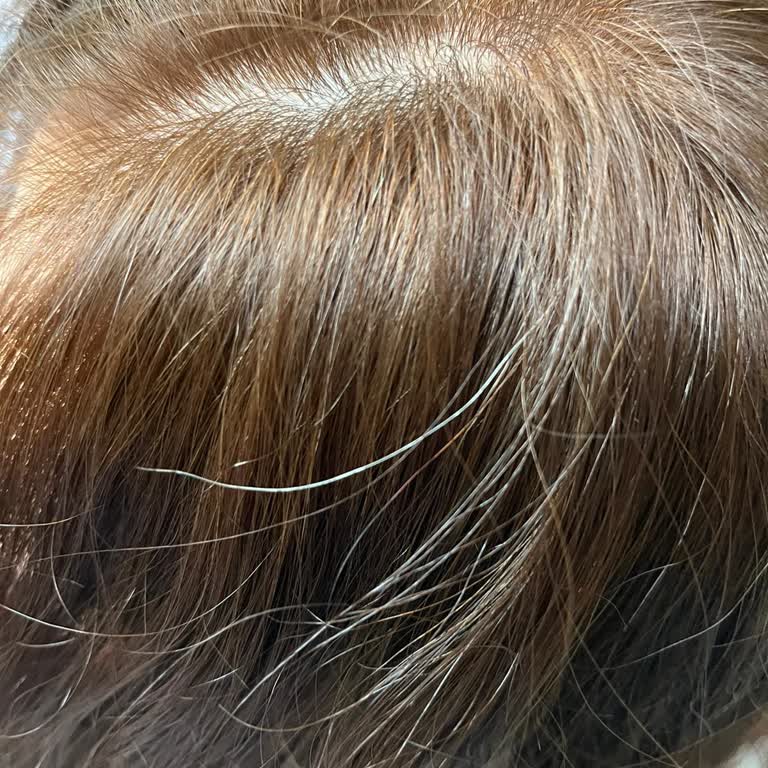 Loreal 7.11 Beyaz Kapatmıyor Ve Görseldeki Renkle Alakası Yok