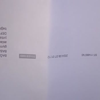 Skechers Ayakkabı Kullanım Sorunları Ve Müşteri Deneyimi