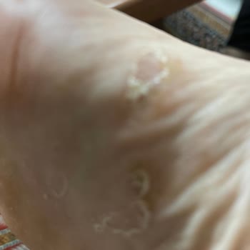 Crocs Terlik & Ayakkabı Sağlık Önemli Tercih Etmemdeki En Önemli Etkendi